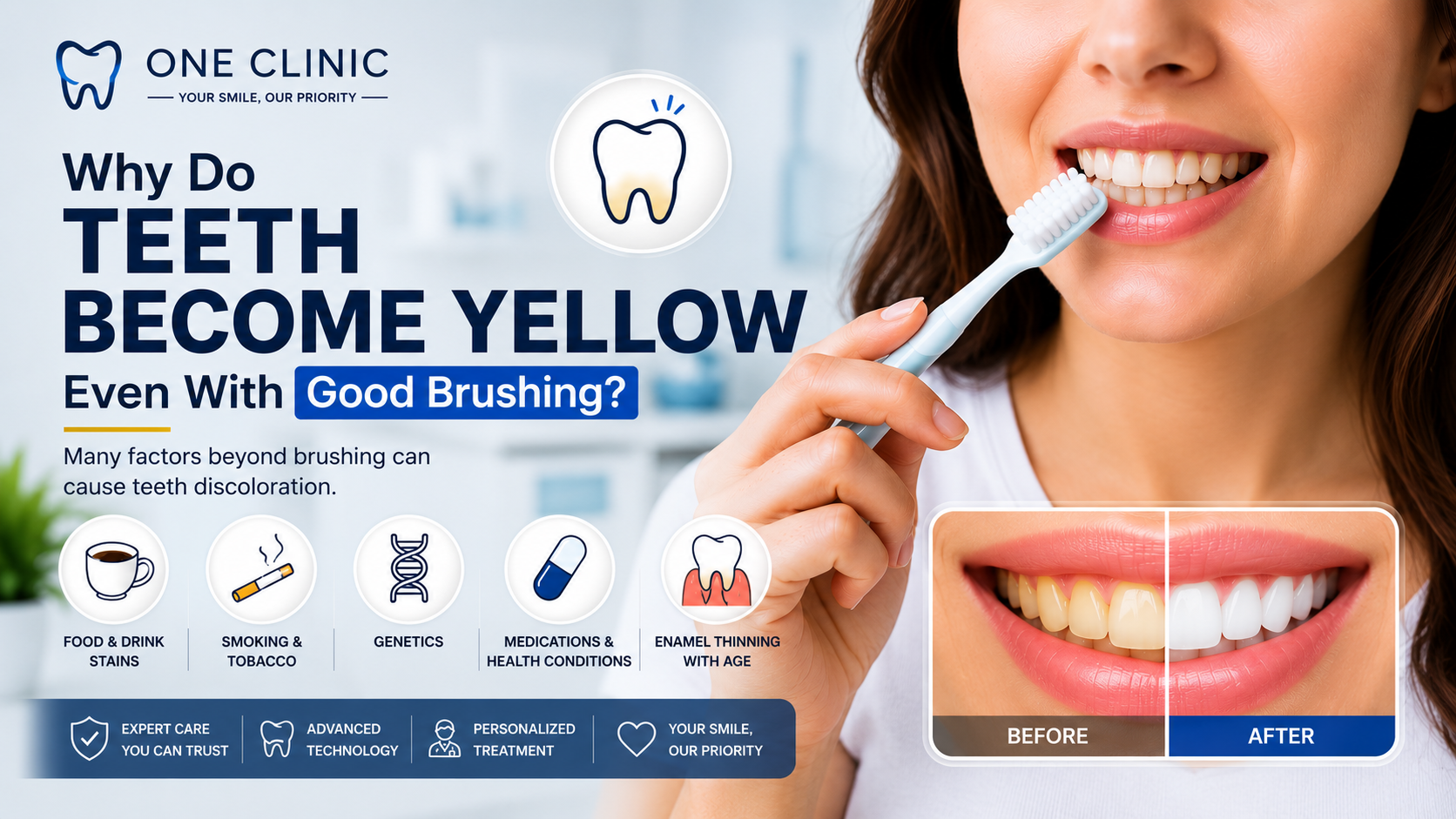 Why Do Teeth Become Yellow Even With Good Brushing?