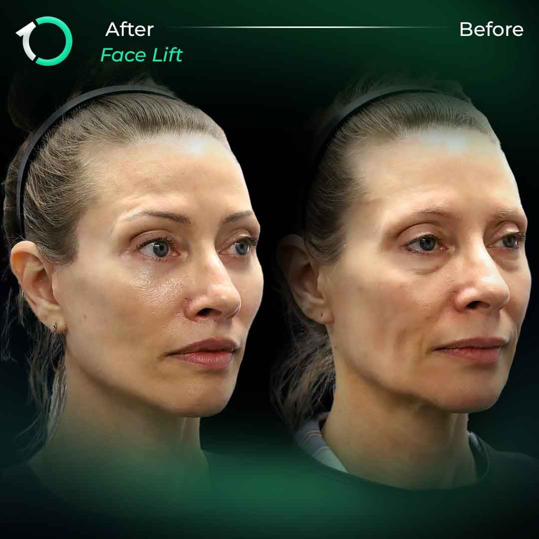 Dr. Alber - Case #3