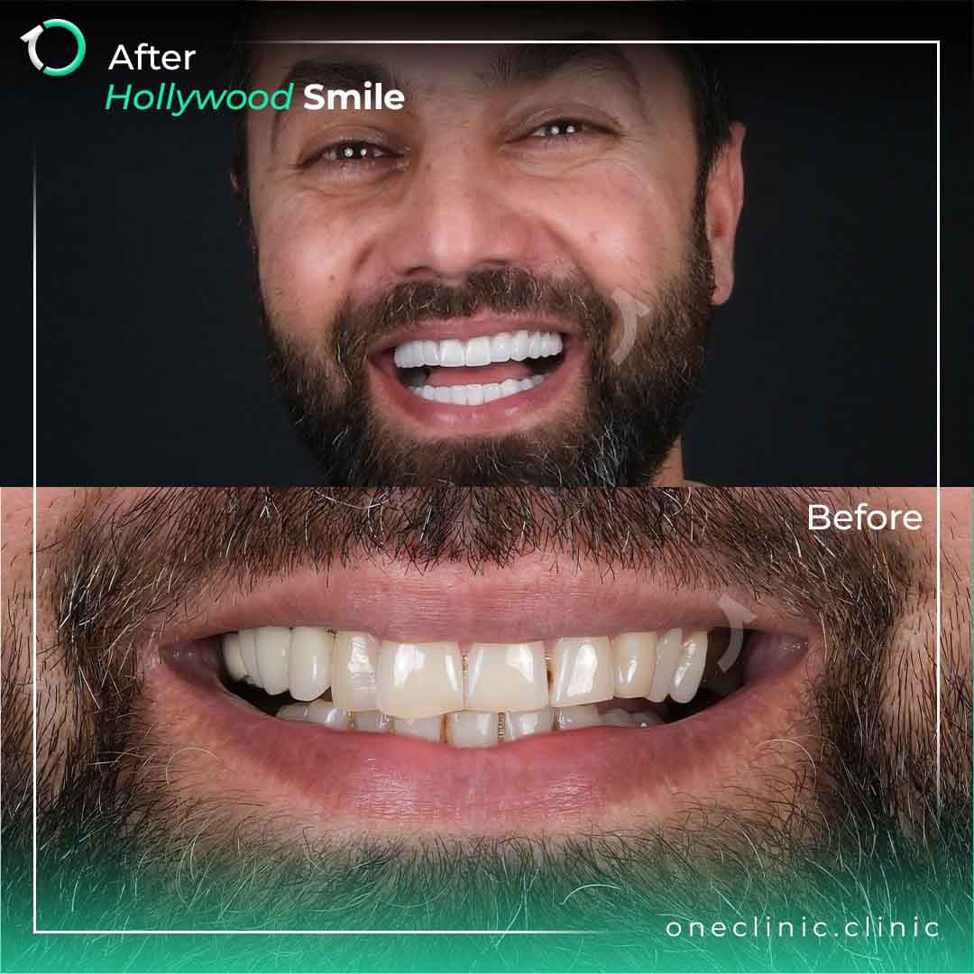 Dr. Esranur Çelik - Case #2