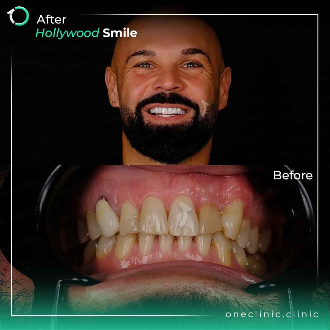 Dr. Esranur Çelik - Case #4