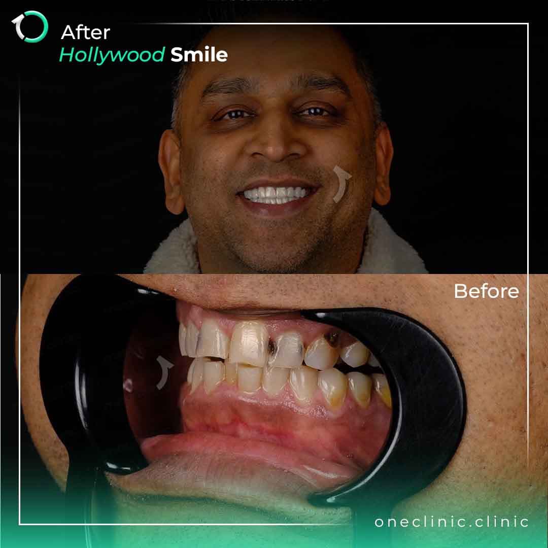 Dr. Muhammad - Case #5